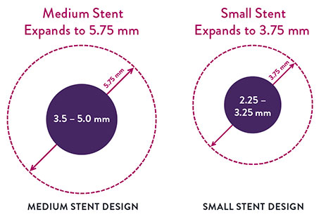 XIENCE DES Stent Expansion Ranges