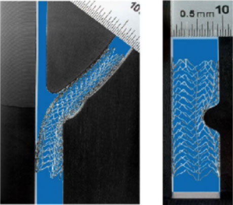 Acculink Carotid Stent extensibility