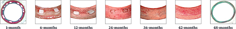Esprit BTK Resorption Timeline