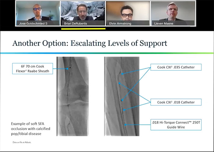 Options for Support: Catheters vs Armada 14 XT
