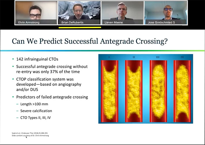 Predictors of Successful Antegrade Crossing