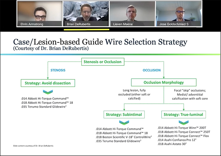 Lesion-based Guide Wire Selection Strategy
