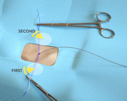 Poor Flow Arterial