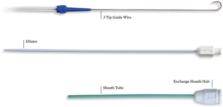 StarClose SE™ Exchange System