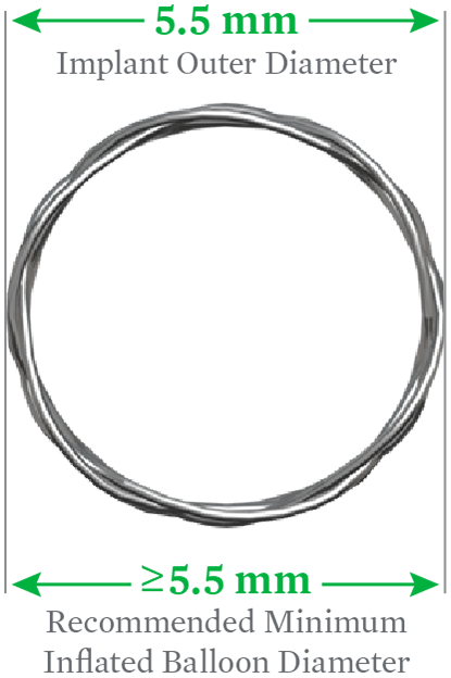 Stent sizing