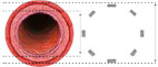 Standard Nitinol Stent