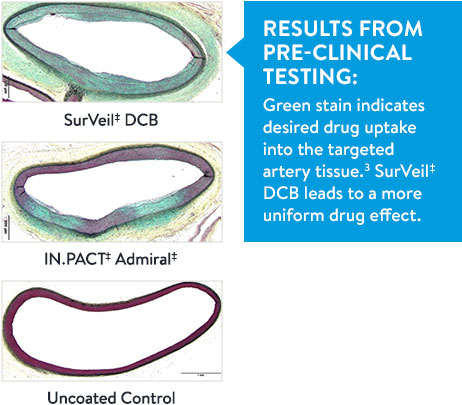 Surveil Drug Coated Balloon coating