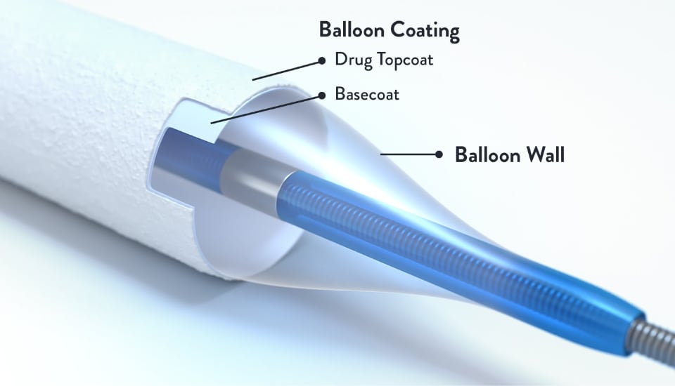 Balloon Coating