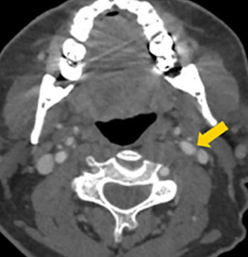 CTA Head image