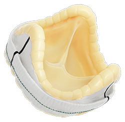 Epic Max aortic stented tissue valve