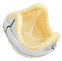 Epic Max aortic stented tissue valve