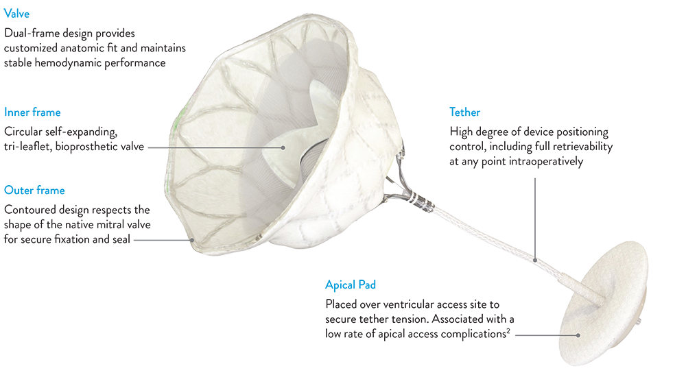  Illustration of the Tendyne mitral valve