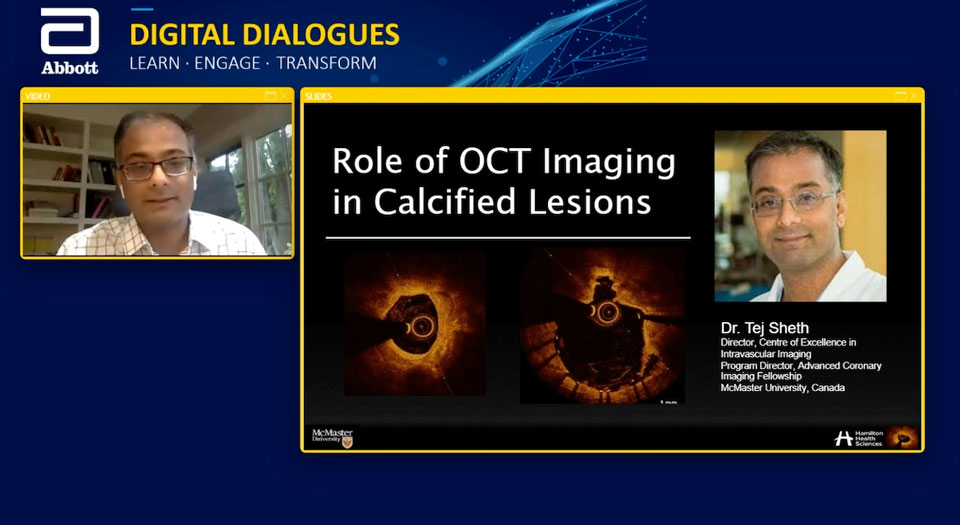 role of OCT imaging in calcified lesions
