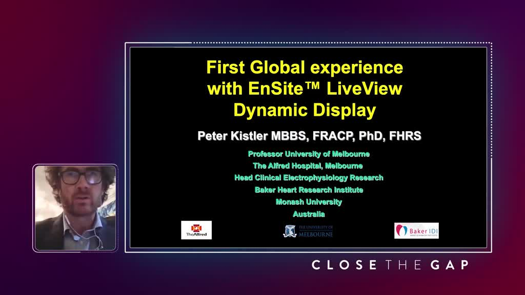 First Global Experience with EnSite LiveView Dynamic Display