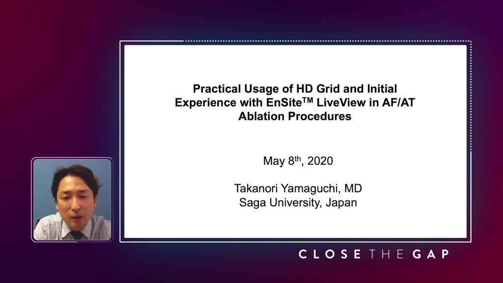 Practical Usage of HD Grid and Initial Experience with EnSite(tm) LiveView in AF/AT Ablation Procedures