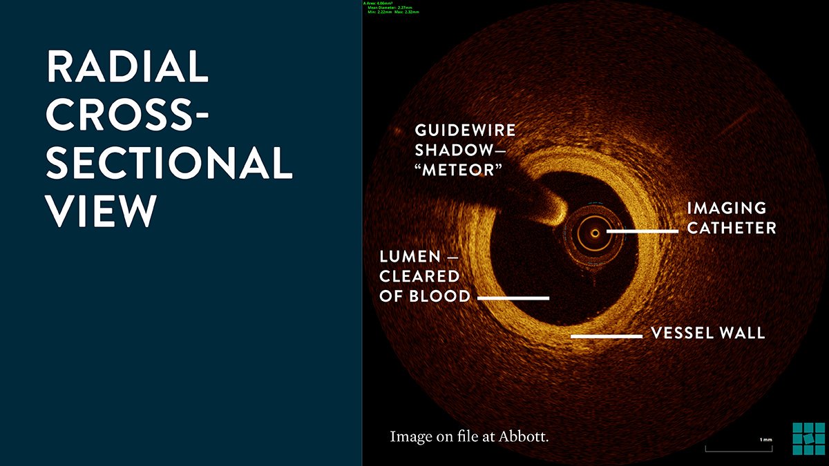  Basics of OCT Image Interpretation