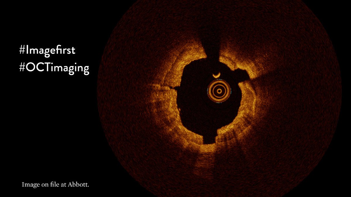   How to diagnose calcium with OCT