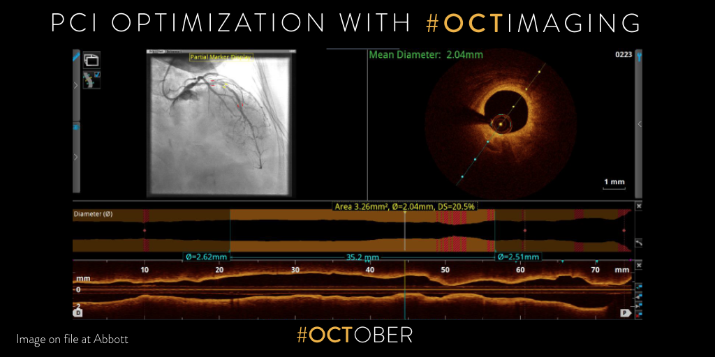 Optimize PCI