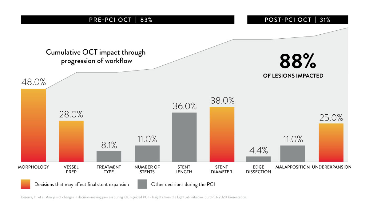  pci oct pre post impact chart