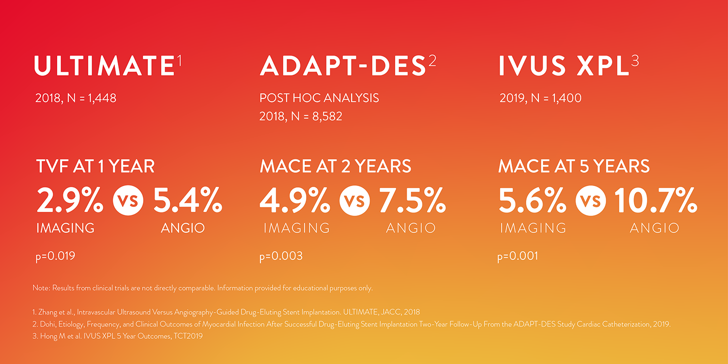 pci oct ultimate adapt des ivus xpl studies