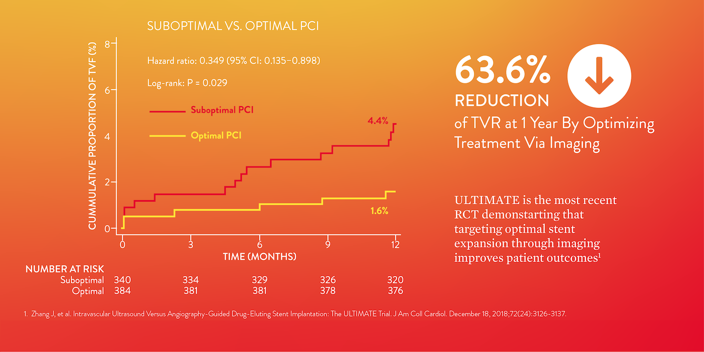 Optical coherence tomography, ULTIMATE trial demonstrates that targeting optimal stent expansion though imaging improves outcomes