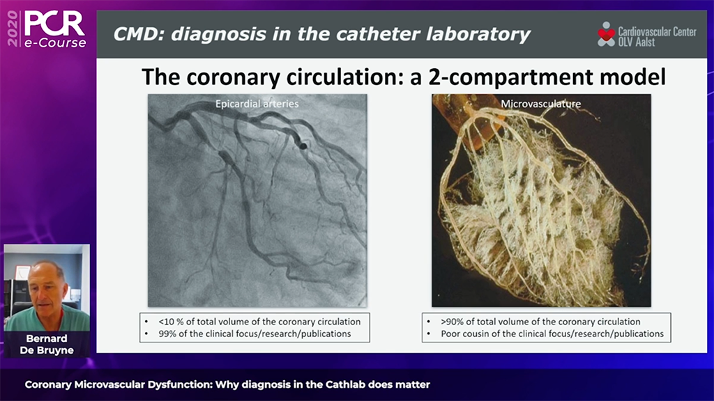 Diagnostik einer koronaren mikrovaskulären Dysfunktion über Angiogramme hinaus