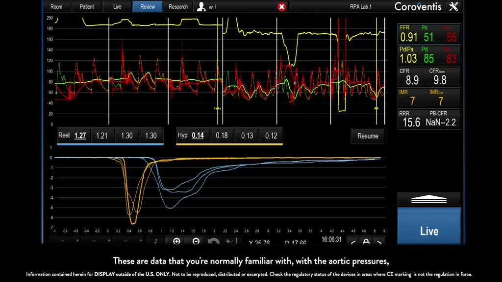 diagnosing inoca patient part 2