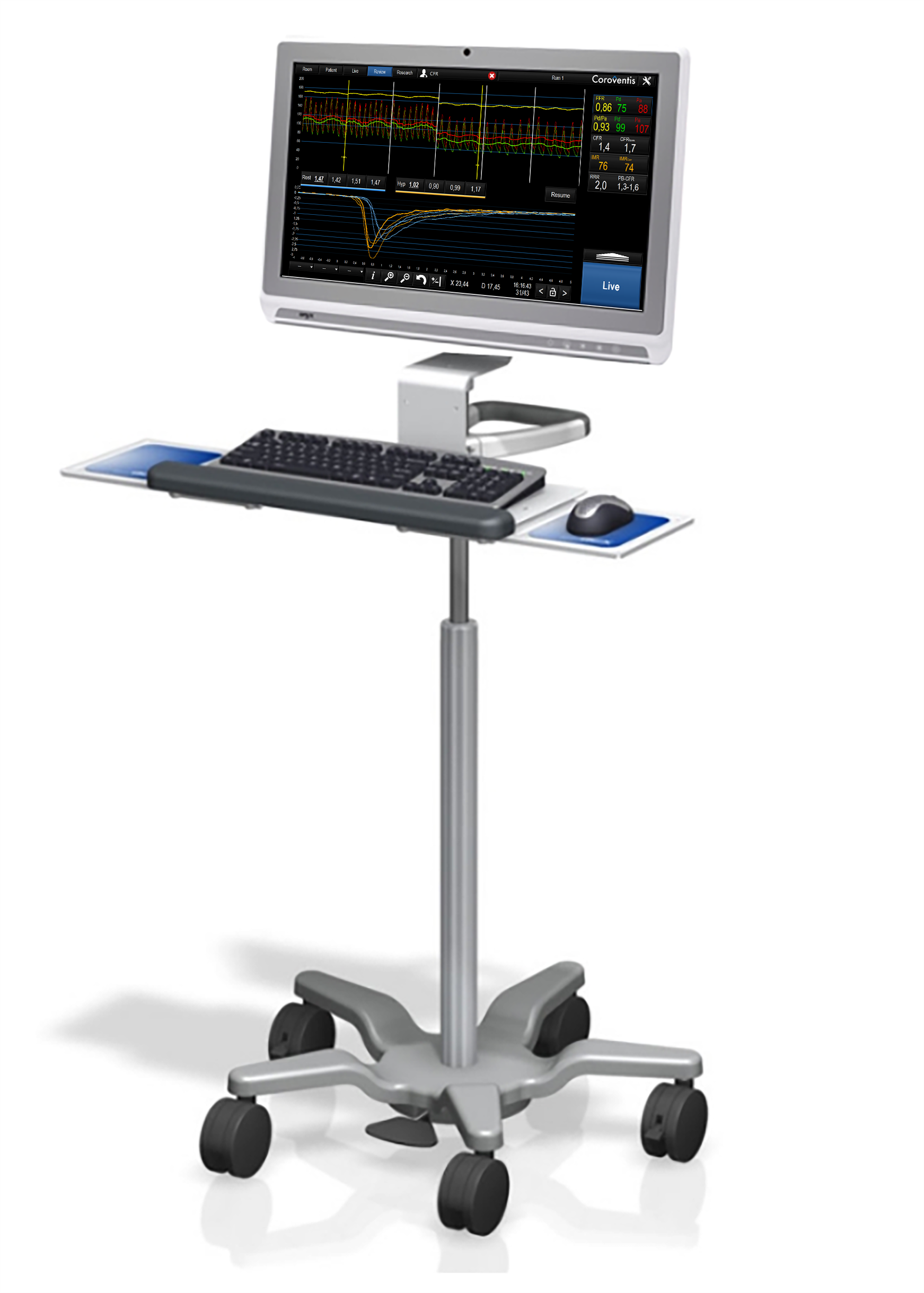 Coroventis mobile cart