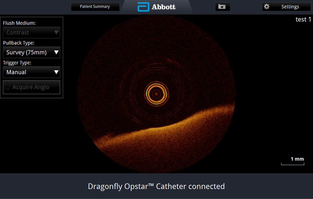 Compatible OPTIS System Screen