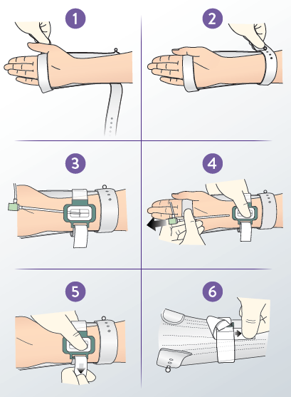 Radistop Deployment Steps