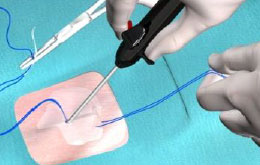 Assess Hemostasis