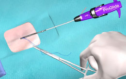 Suture Management