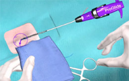 Suture Management