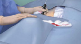 Assess Hemostasis
