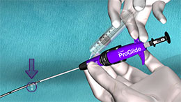 Flush Marker Lumen