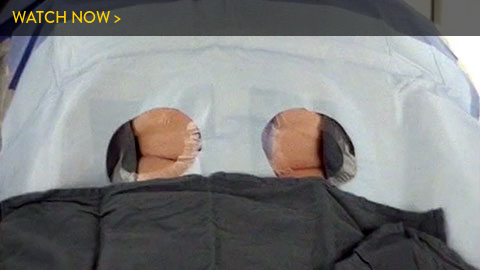 patient preparation