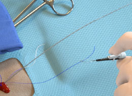 EOP Suture Management