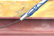  tangled suture