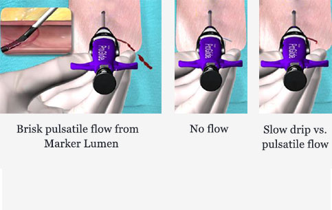  flow types