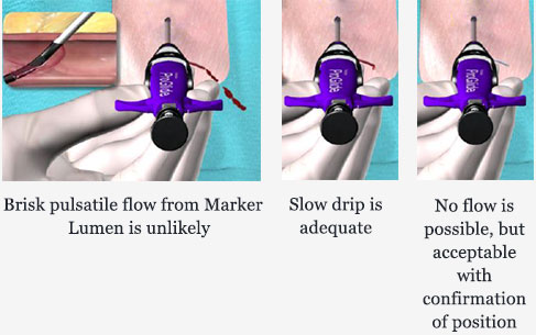  proper flow types