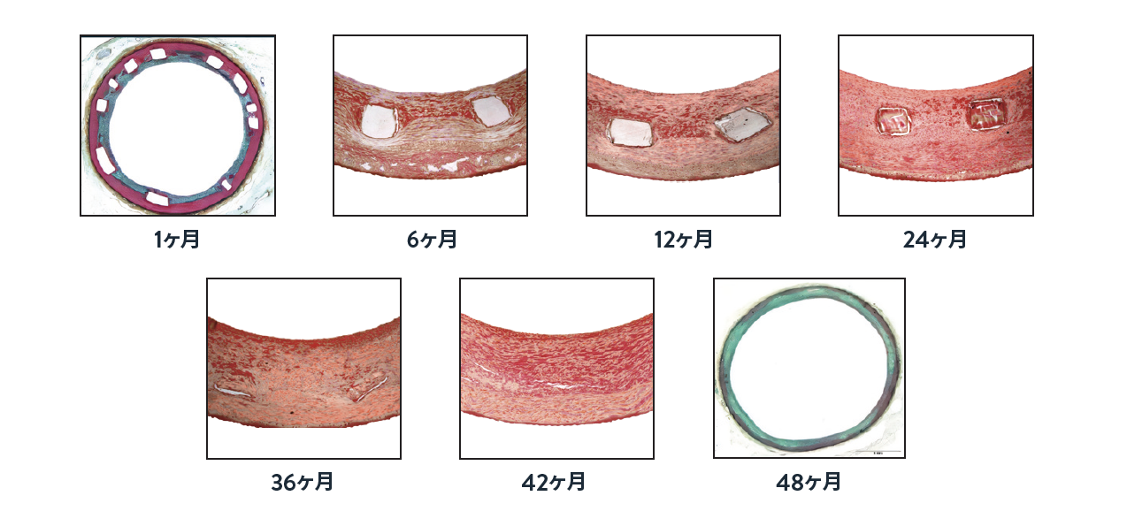 Esprit BTK Resorption Timeline