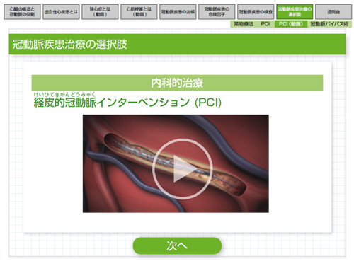 PCI Video