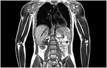 torso MRI scan