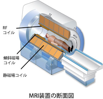 MRI装置の断面図