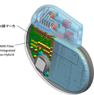 pacemaker diagram