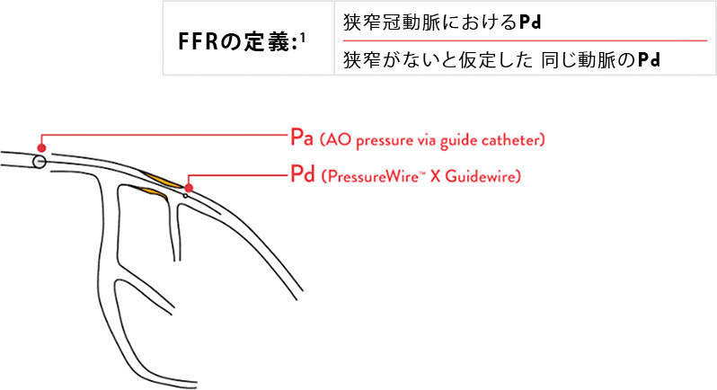 FFRの測定 chart and graphic