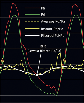 resting full cycle ratio graph