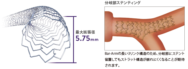 XIENCE Skypoint Stent 