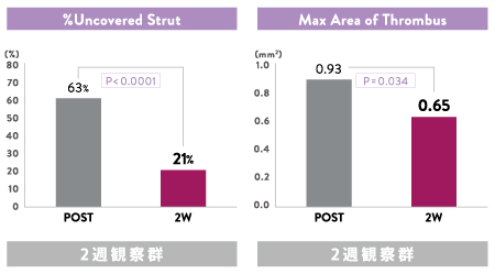 xience stent