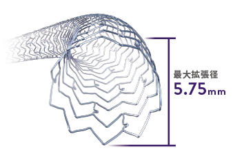 XIENCE Skypoint Stent